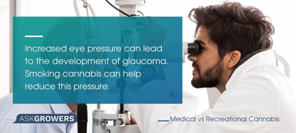 Cannabis for Glaucoma